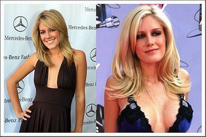 List Of 20 Celebrities With Breast Augmentation