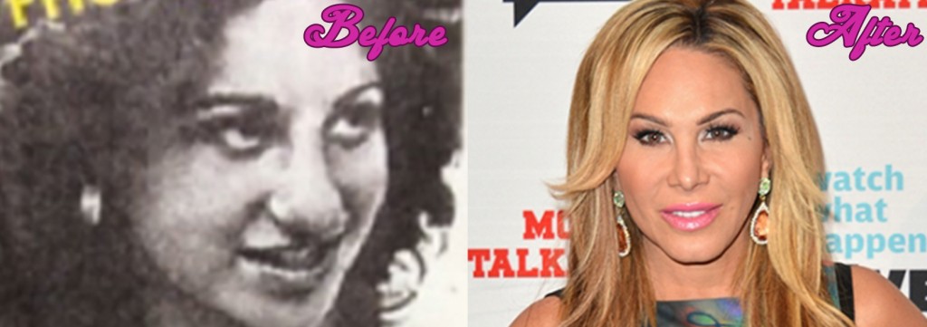 Adrienne Maloof Before Plastic Surgery