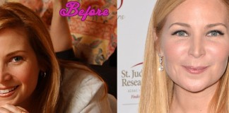 Jennifer Westfeldt Plastic Surgery Before and After Pics