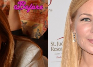 Jennifer Westfeldt Plastic Surgery Before and After Pics