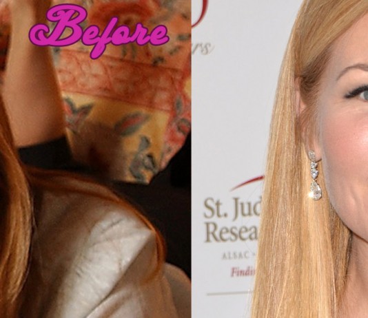 Jennifer Westfeldt Plastic Surgery Before and After Pics