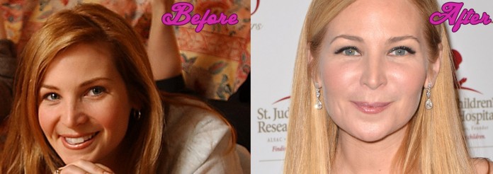 Jennifer Westfeldt Plastic Surgery Before and After Pics