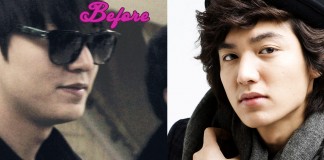 Lee Min Ho Plastic Surgery photo, pic