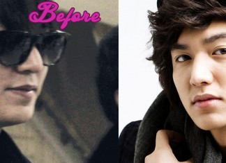 Lee Min Ho Plastic Surgery photo, pic