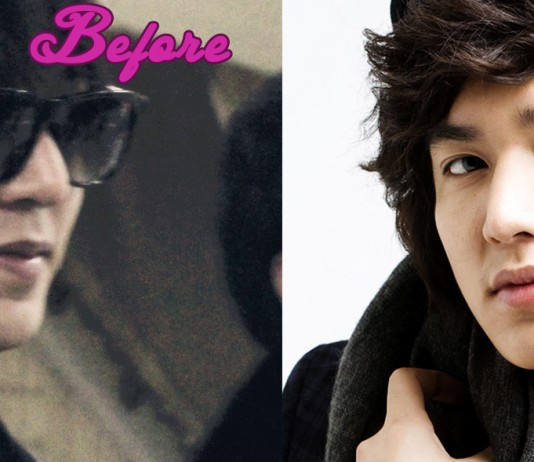 Lee Min Ho Plastic Surgery photo, pic