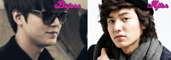 Lee Min Ho Plastic Surgery photo, pic