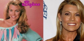 Vanna White Plastic Surgery Before and After Photos