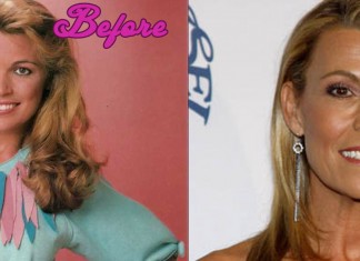 Vanna White Plastic Surgery Before and After Photos