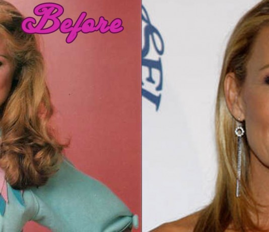 Vanna White Plastic Surgery Before and After Photos