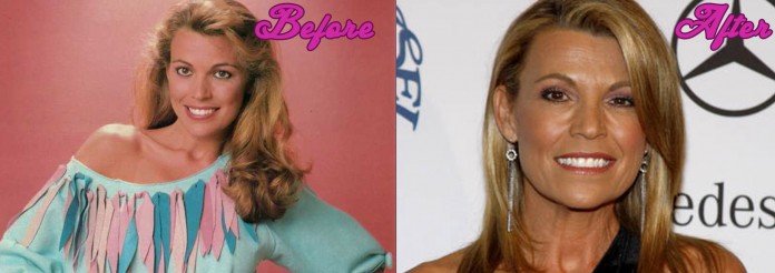 Vanna White Plastic Surgery Before and After Photos