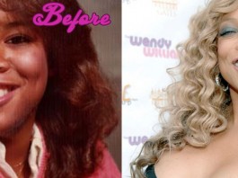 Wendy Williams Plastic Surgery Before and After