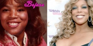 Wendy Williams Plastic Surgery Before and After