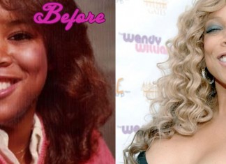 Wendy Williams Plastic Surgery Before and After