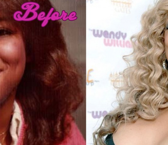 Wendy Williams Plastic Surgery Before and After
