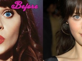 Zooey Deschanel Before and After Surgery Pictures