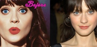 Zooey Deschanel Before and After Surgery Pictures