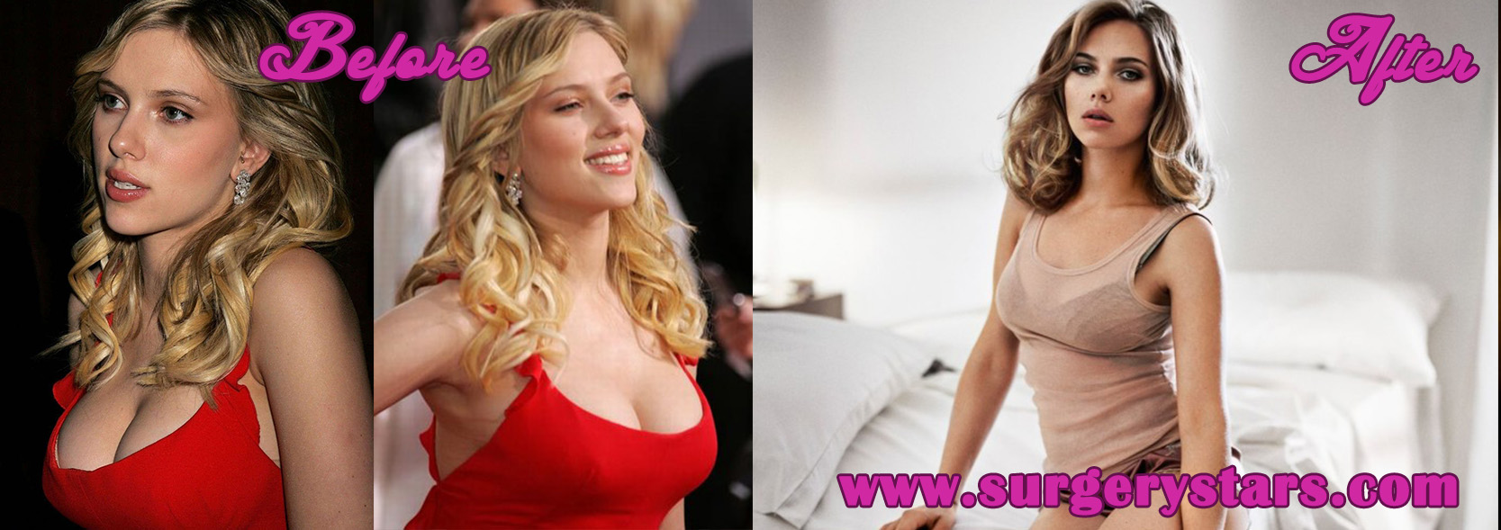 actress,actresses,before and after pics,boob job,bra size,breast augmentati...
