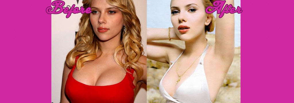 Scarlett Johansson Breast Reduction Photos