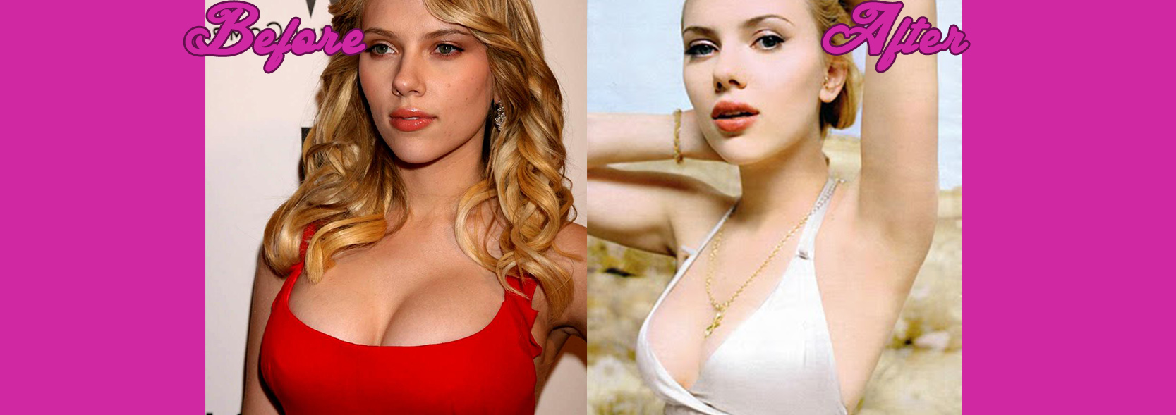 Scarlett Johansson has constantly denied that she has undergone plastic sur...