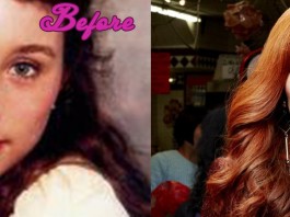 Tori Amos Plastic Surgery Before And After