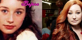 Tori Amos Plastic Surgery Before And After