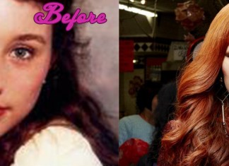 Tori Amos Plastic Surgery Before And After