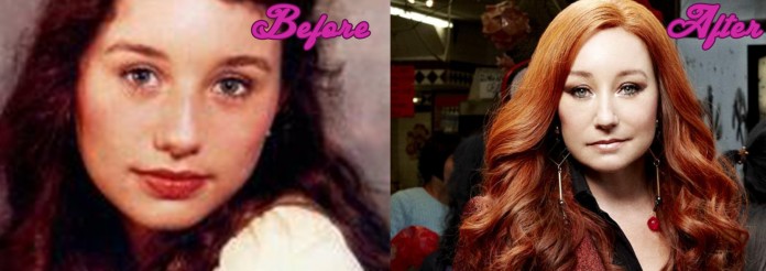 Tori Amos Plastic Surgery Before And After