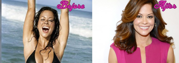 Brooke Burke Plastic Surgery - Before and After Pics