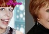 Carol Burnett plastic surgery - Before and After Pictures
