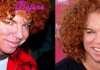 Carrot Top Before and After Cosmetic Surgery Pics