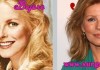 Cheryl Ladd Plastic Surgery Before and After Pictures