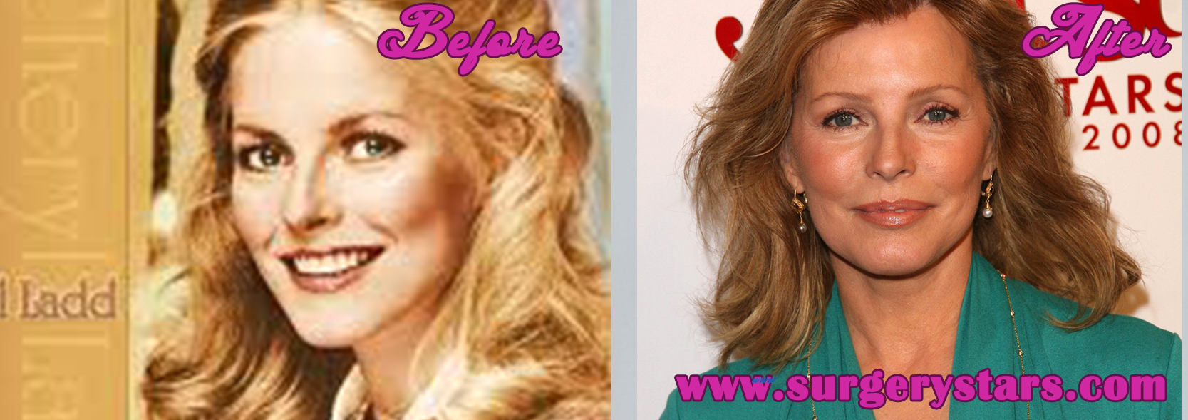 cheryl ladd plastic surgery before and after