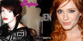 Christina Hendricks Plastic Surgery