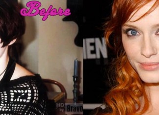 Christina Hendricks Plastic Surgery