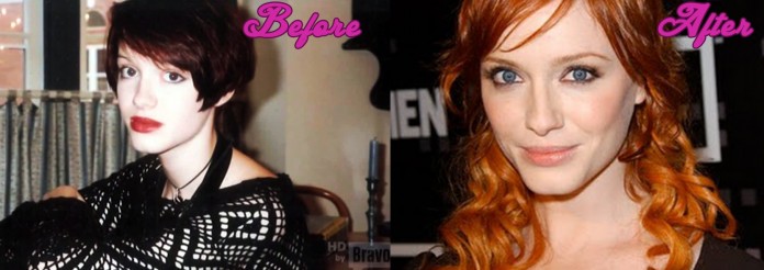 Christina Hendricks Plastic Surgery