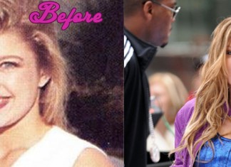 Fergie Plastic Surgery Pictures