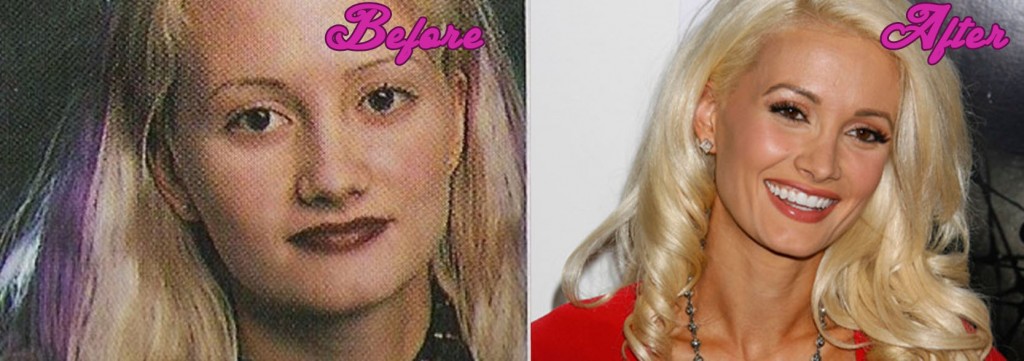 Holly Madison Plastic Surgery Pictures