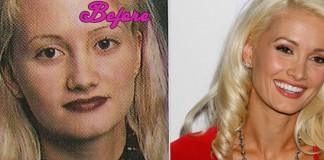 Holly Madison Plastic Surgery Pictures