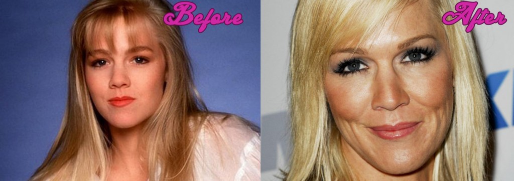 Jennie Garth Plastic Surgery Photos