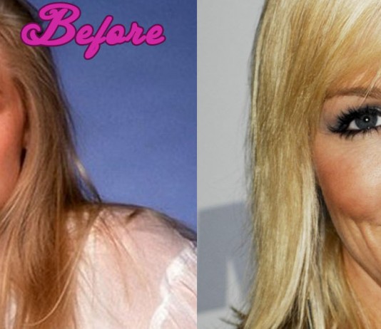 Jennie Garth Plastic Surgery Photos