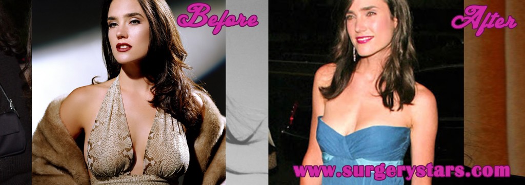 Jennifer Connolly  Breast Reduction pic