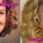 Kristin Chenoweth Plastic surgeries Before and After