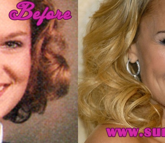 Kristin Chenoweth Plastic surgeries Before and After