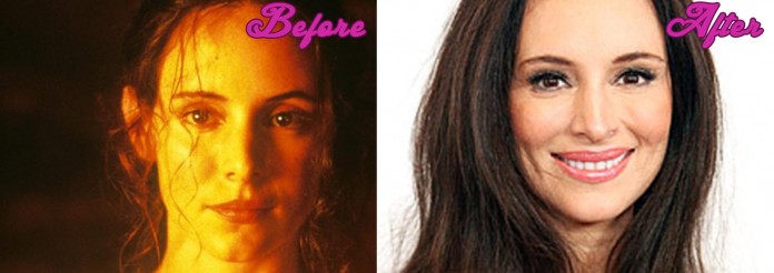 Madeleine Stowe Plastic Surgery, before and after