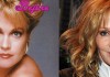 Melanie Griffith's Plastic Surgery Mistakes Pictures
