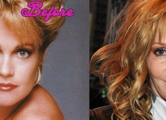 Melanie Griffith's Plastic Surgery Mistakes Pictures