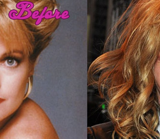 Melanie Griffith's Plastic Surgery Mistakes Pictures