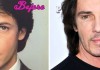 Rick Springfield Plastic Surgery Before and After Pictures