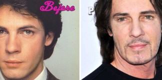 Rick Springfield Plastic Surgery Before and After Pictures