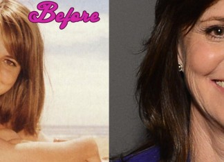 Sally Field Plastic Surgery Pictures